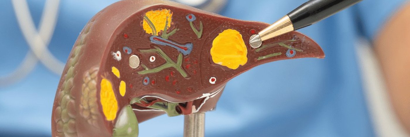 Liver Cancers: CRLM, HCC and Cholangiocarcinoma